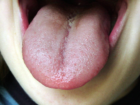 The tongue is covered with many little tissue projections called papillae. 